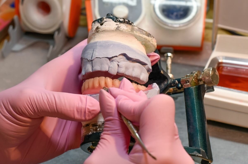 Technik dentystyczny – zawód medyczny czy chemiczny?