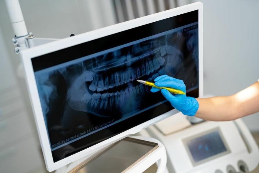 ADA: nowe rekomendacje w radiologii stomatologicznej
