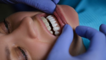 gingiwektomia