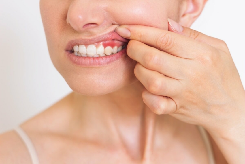 Periodontitis wpływa na gojenie się ran