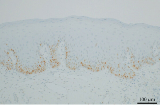 szpiczak 6