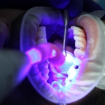 dentist 7397734 1280