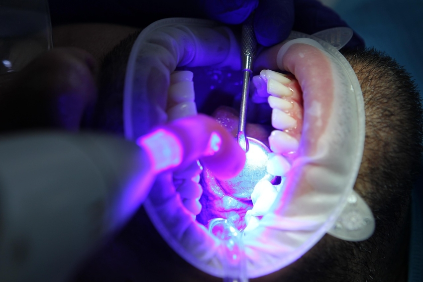 Journal of Dentistry: Jak przedłużyć efekt wybielania zębów?