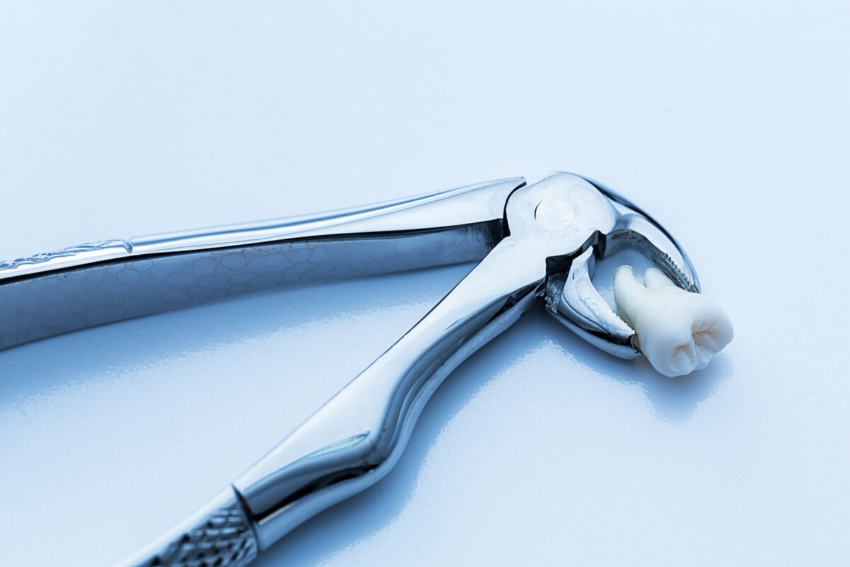 USA: Mnogie ekstrakcje i areszt dla fałszywego dentysty