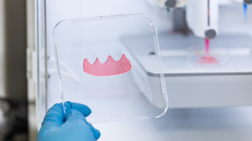 AI i biodruk 3D rewolucjonizują przeszczepy tkanek miękkich jamy ustnej