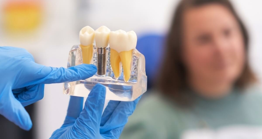 Przed Brånemarkiem – krótka historia implantów