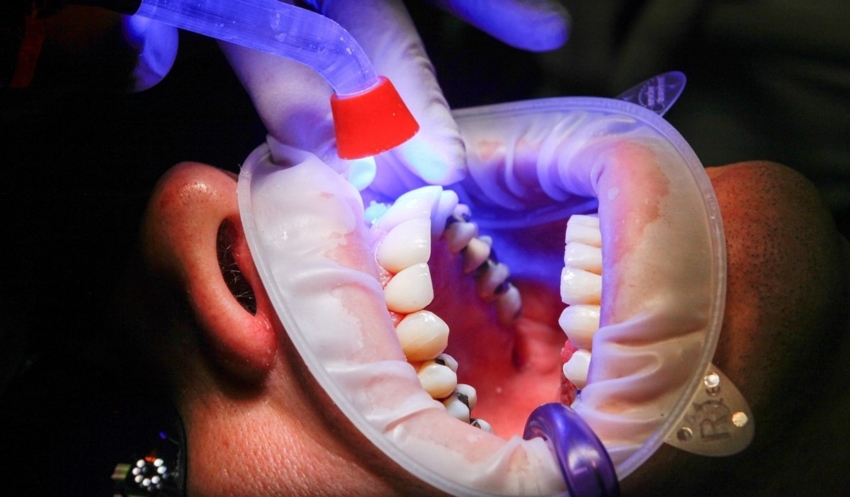 Chirurgia ogólna w służbie stomatologii – kiedy problemy jamy ustnej wymagają skalpela poza gabinetem dentysty?
