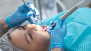 leczenie periodontologiczne2