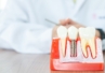 Przyczyny odrzucenia implantu zęba, czyli dlaczego implant się nie przyjął